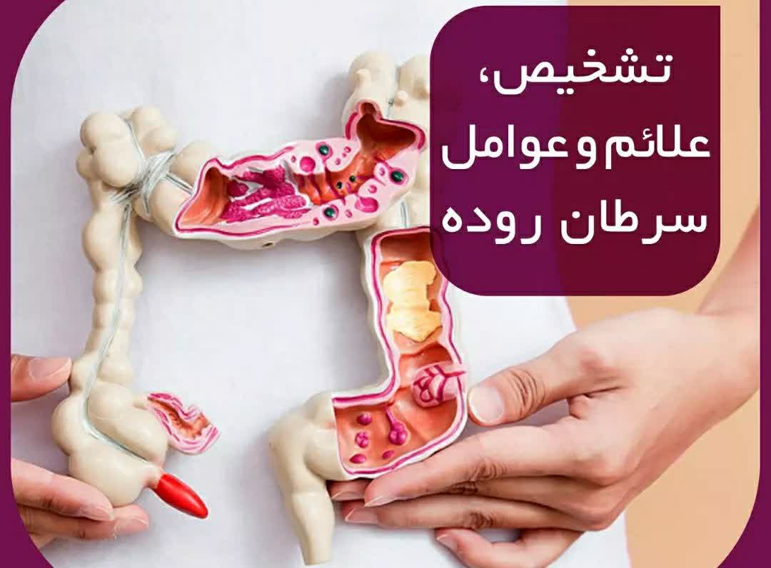 تشخیص،علائم و عوامل سرطان روده