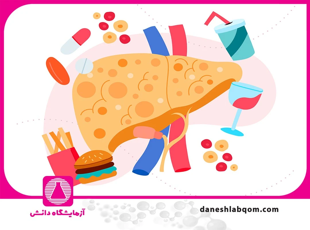تفاوت کبد چرب گرید ۱، ۲ و ۳ : آزمایش و نکات آن