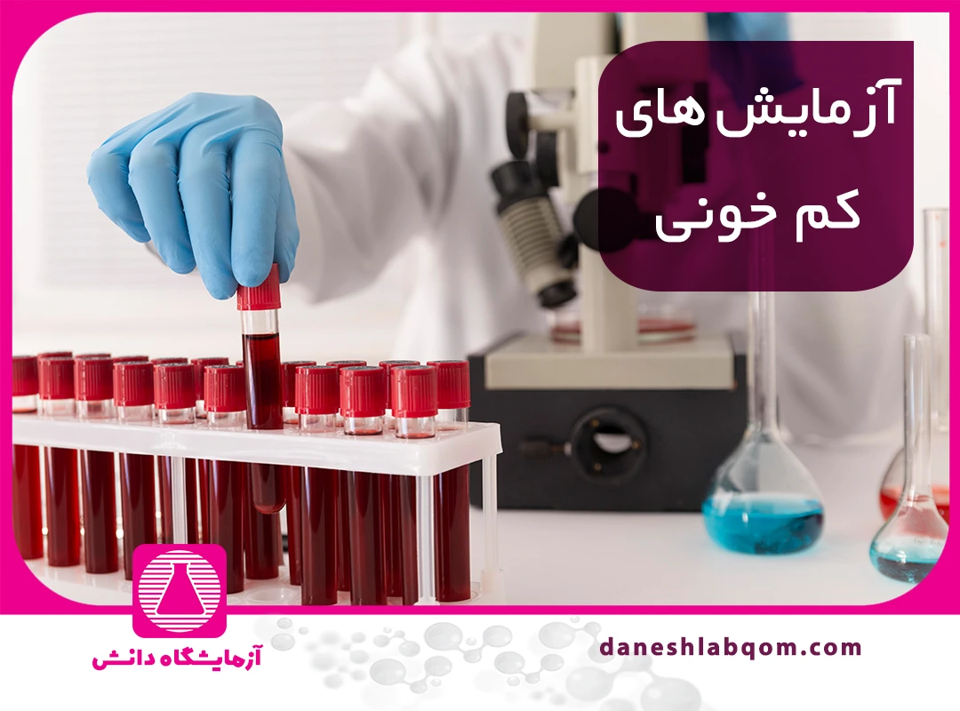 آزمایش کم خونی | روشهای تشخیص، انواع آنمی و تفسیر نتایج