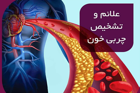 علائم و تشخیص چربی خون