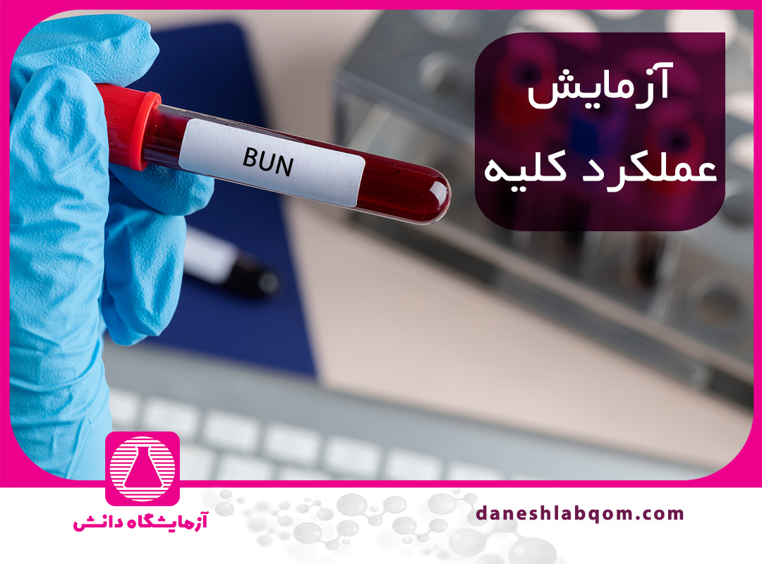 آزمایش عملکرد کلیه ( اینکه BUN و کراتینین چه چیزی نشان میدهند؟)
