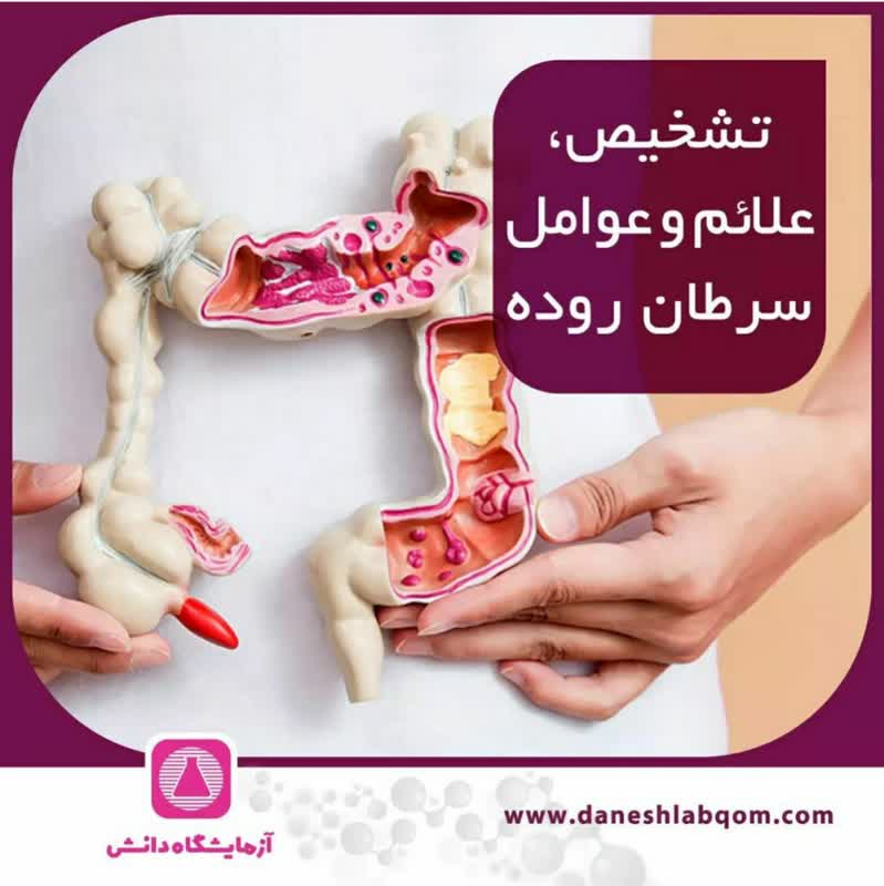 تشخیص،علائم و عوامل سرطان روده