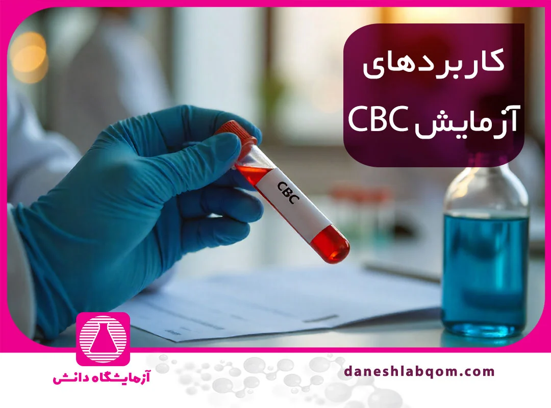 آزمایش CBC چیست؟ راهنمای تفسیر نتایج و بیماری‌ها