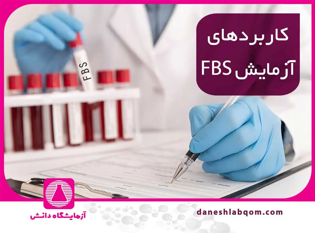 آزمایش قند خون | آنچه باید درباره انجام و تفسیر جواب بدانید