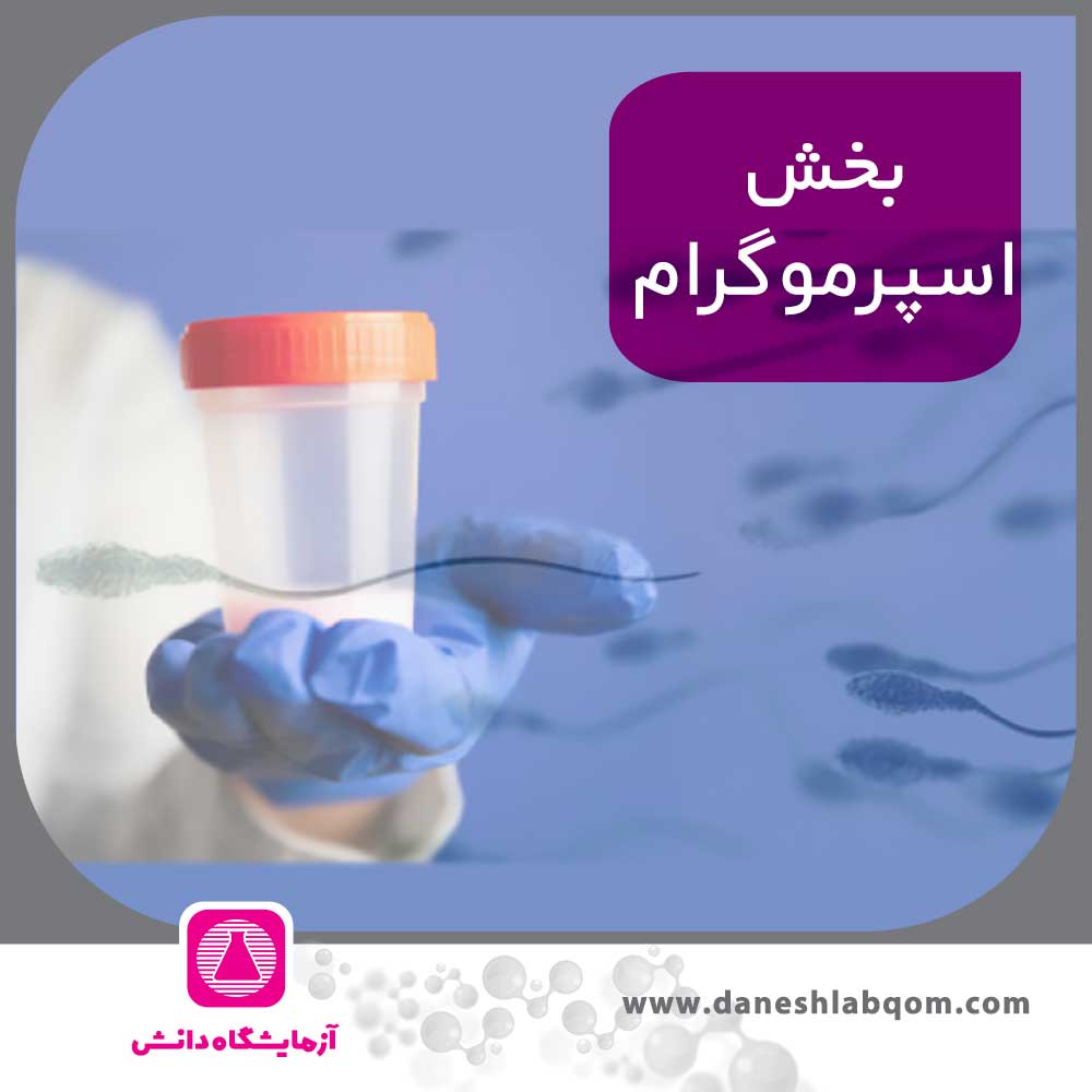 اسپرموگرام