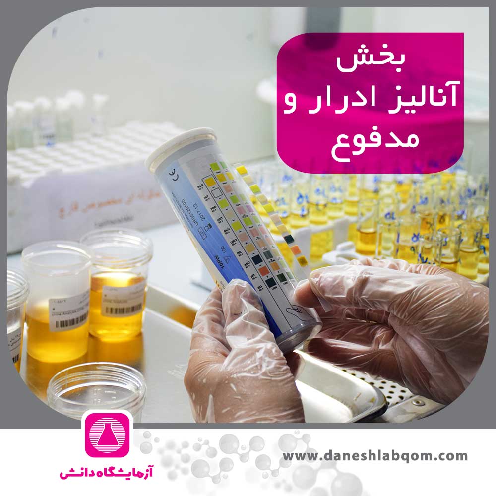 آنالیز ادرار و مدفوع